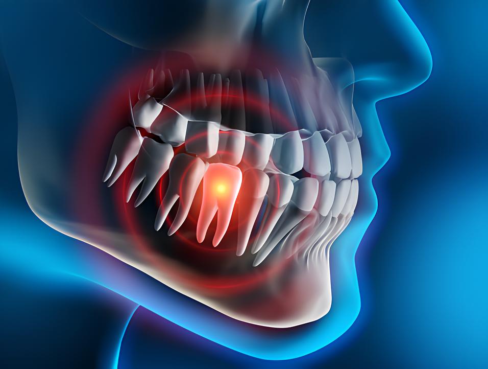 Teeth image - Emergency dentist Aylesbury